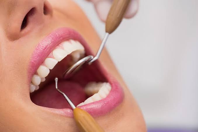Close-up of an open mouth as dental instruments examine the teeth, brightly lit against a pale background.