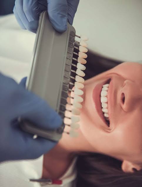 Close-up of a smiling patient while gloved hands hold a dental shade guide near the teeth, softly lit.